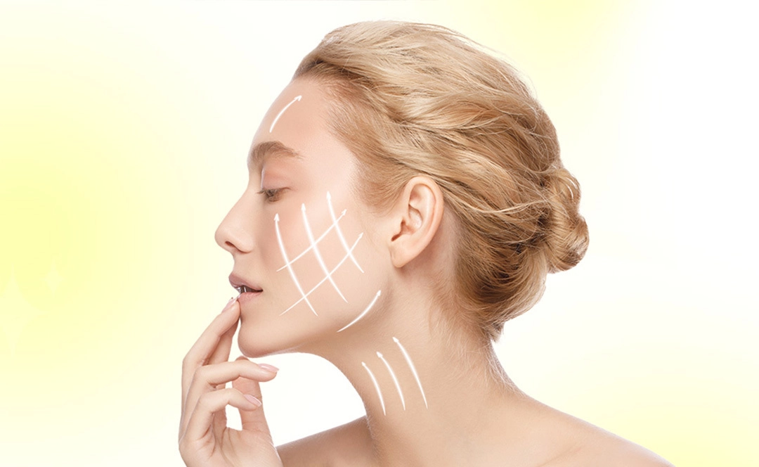 Dermal Filler Treatment