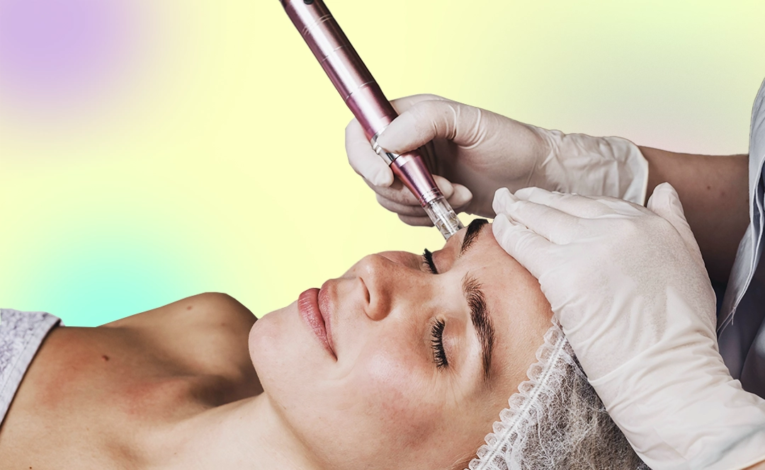 Microneedling